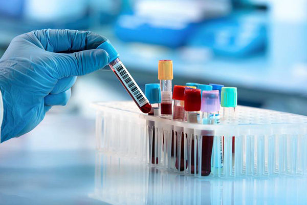 The Latest News on NMN: New Findings Revealed