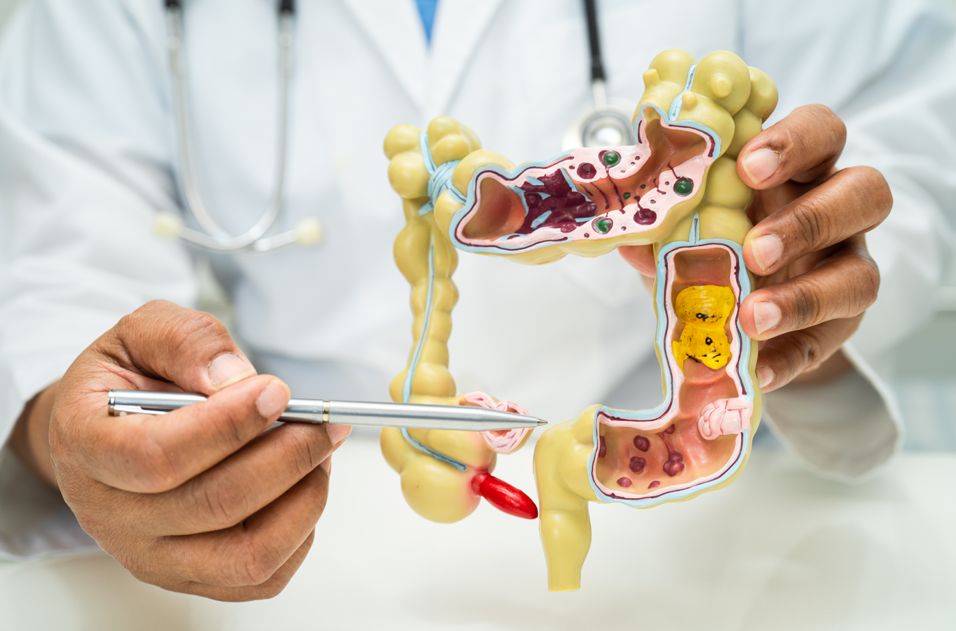 NMN Protects Against Colon Cancer, New Study Finds – Rejuve+ Health Products